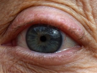 Atteso 1 milione di over 90 nei prossimi 3 anni